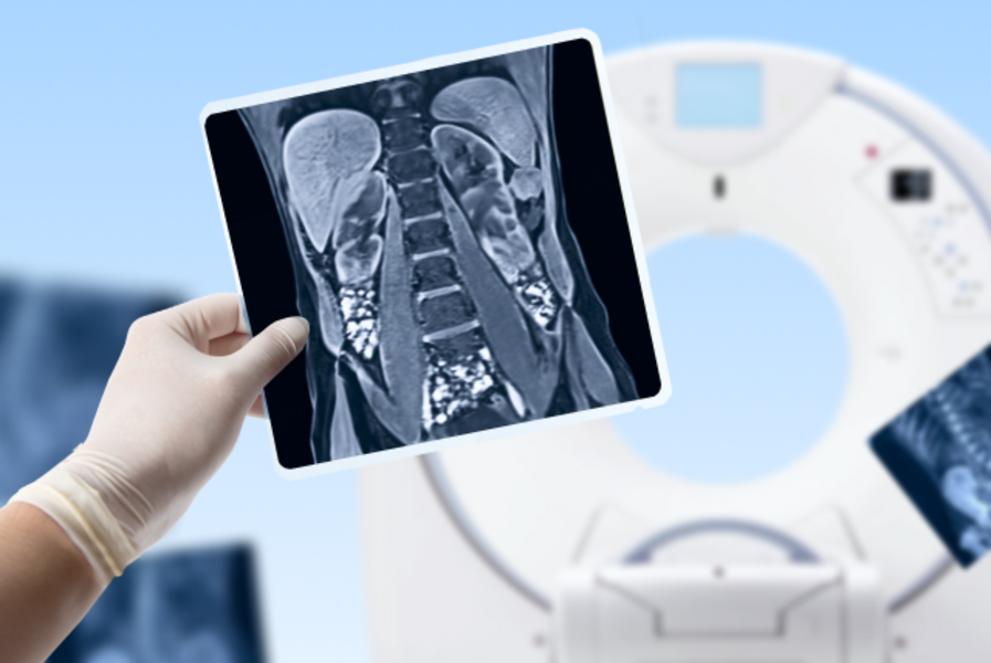 Комплекс КТ "Весь живот"